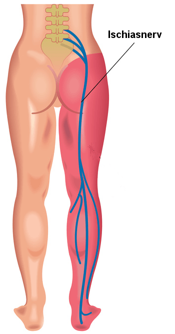 ischiasnerv-bein.png